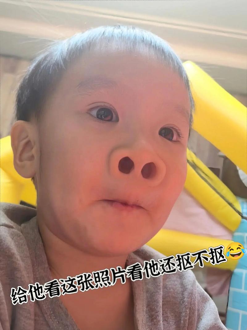 挖鼻孔满脸肿胀变形,挖鼻孔满脸肿胀变形怎么办